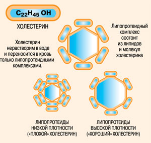 Проявления и виды атеросклероза