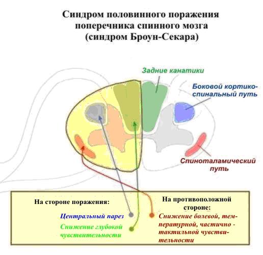 Изображение с сайта www.neurosar.ru