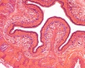 Esophagus SEC (2)