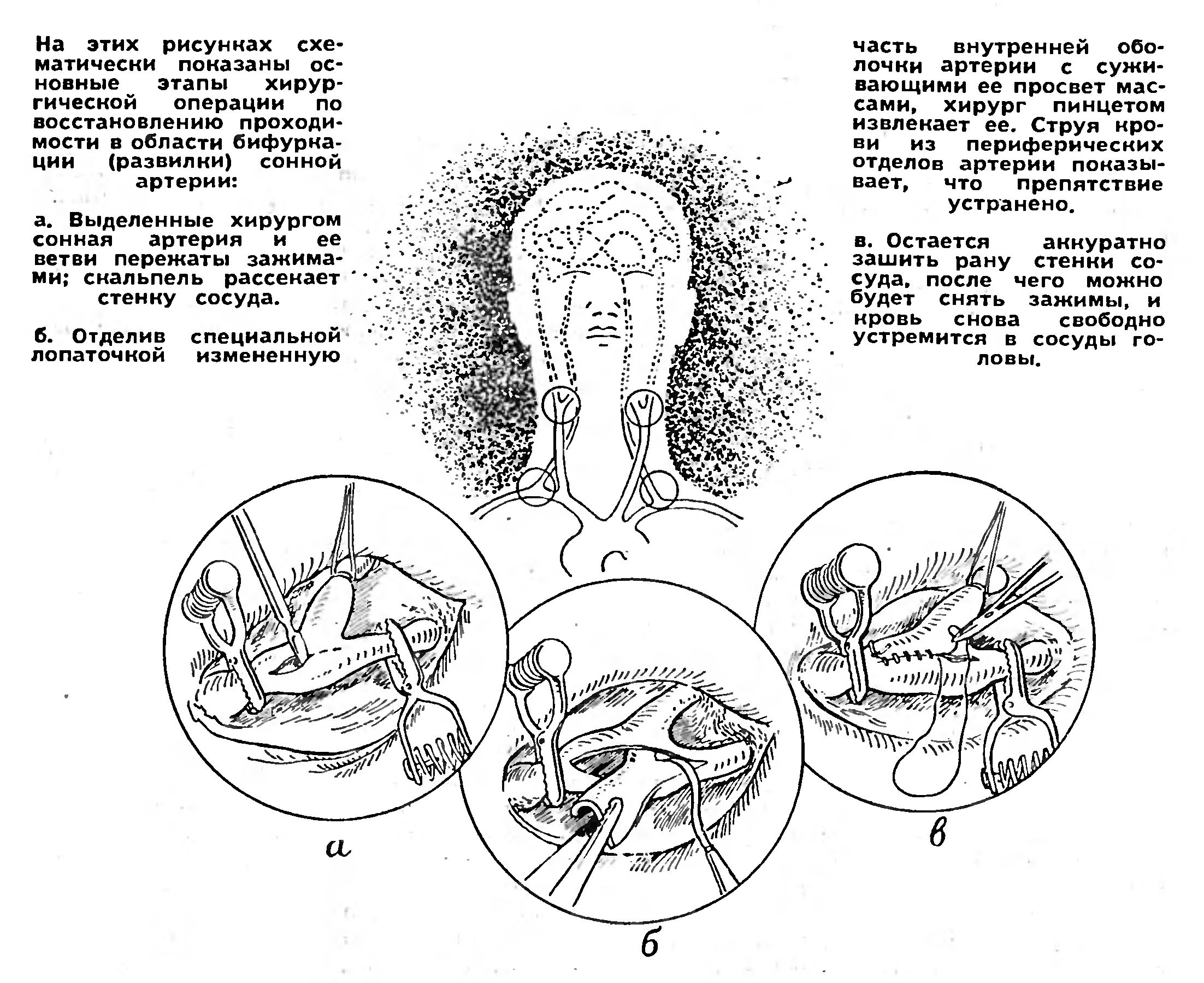 ХИРУРГИЯ - ПРОБЛЕМЫ, ПОИСКИ   