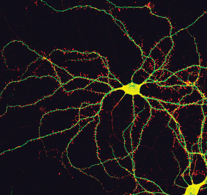 Один из нейронов мозга. (Фото: The Journal of Cell Biology / Flickr.com.)