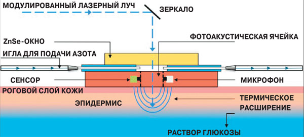 Лазер измеряет сахар у диабетиков