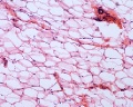 ADIPASE TISSUE Sec microscope Jenaval 1280x1024 (1)