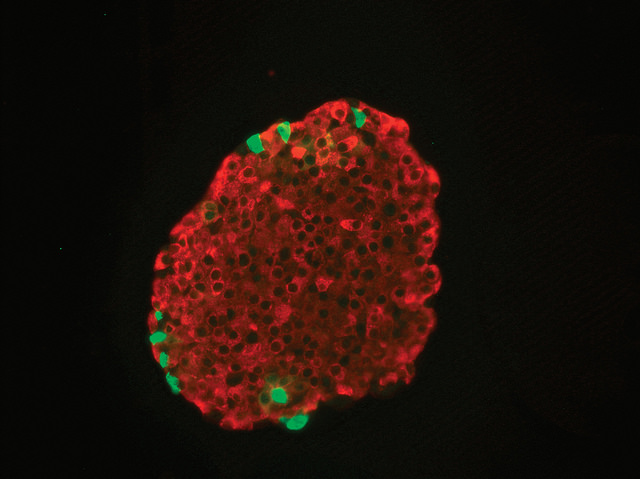Островок Лангерганса – скопление инсулинсинтезирующих клеток в поджелудочной железе. (Фото: UWMadisonCALS / Flickr.com.)
