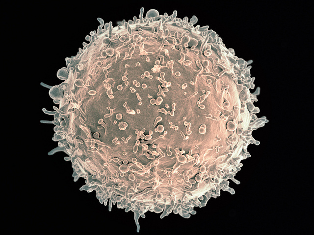 Человеческий В-лимфоцит под электронным сканирующим микроскопом. (Фото: NIAID / Flickr.com.)