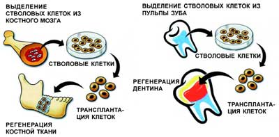 Стволовые клетки в стоматологии презентация