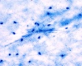 Nerve cell smear