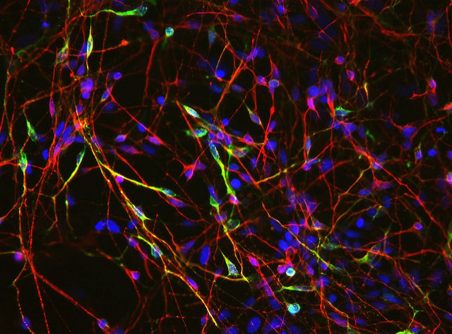 Нейроны, выращенные из эмбриональных стволовых клеток; желтым цветом окрашены нервные клетки, синтезирующие дофамин. (Фото: California Institute for Regenerative Medicine / Flickr.com.)