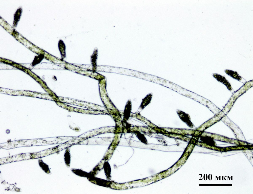 Vaucheria compacta мужские нити_1.jpg