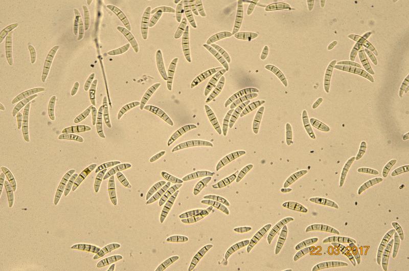 Конидии грибов р. Fusarium._no coorr.jpg