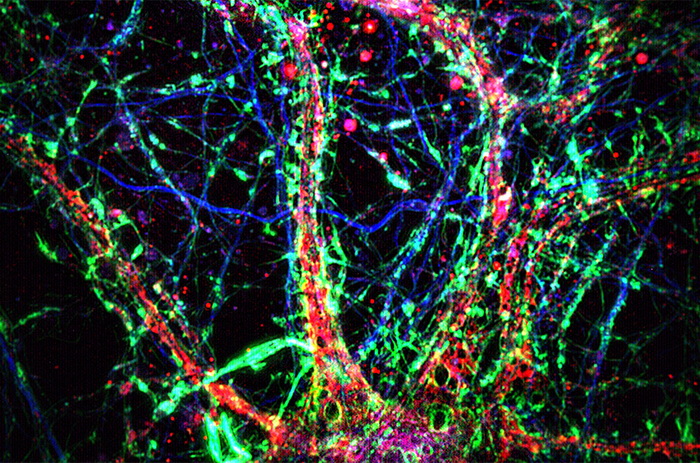 нейроны трубки.jpg