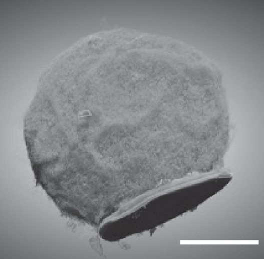 моноцит с имплантатом.png