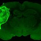 В крысиный мозг добавили человеческого
