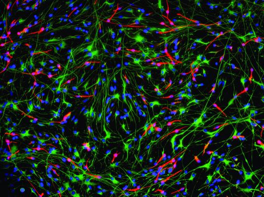 Человеческие нервные стволовые клетки из коры мозга эмбриона. (Фото: GE Healthcare / Flickr.com) 