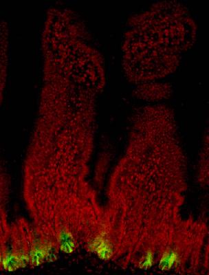 Ð¡ÑÐ²Ð¾Ð»Ð¾Ð²ÑÐµ ÐºÐ»ÐµÑÐºÐ¸ (Ð¾ÐºÑÐ°ÑÐµÐ½Ñ Ð·ÐµÐ»ÐµÐ½ÑÐ¼) Ð² ÑÐ¾Ð½ÐºÐ¾Ð¹ ÐºÐ¸ÑÐºÐµ Ð¼ÑÑÐ¸. (Ð¤Ð¾ÑÐ¾: California's Stem Cell Agency)&nbsp;